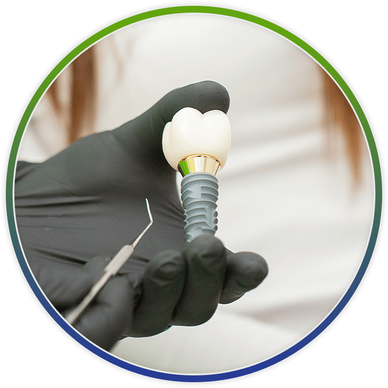 dentist holding a single dental implant