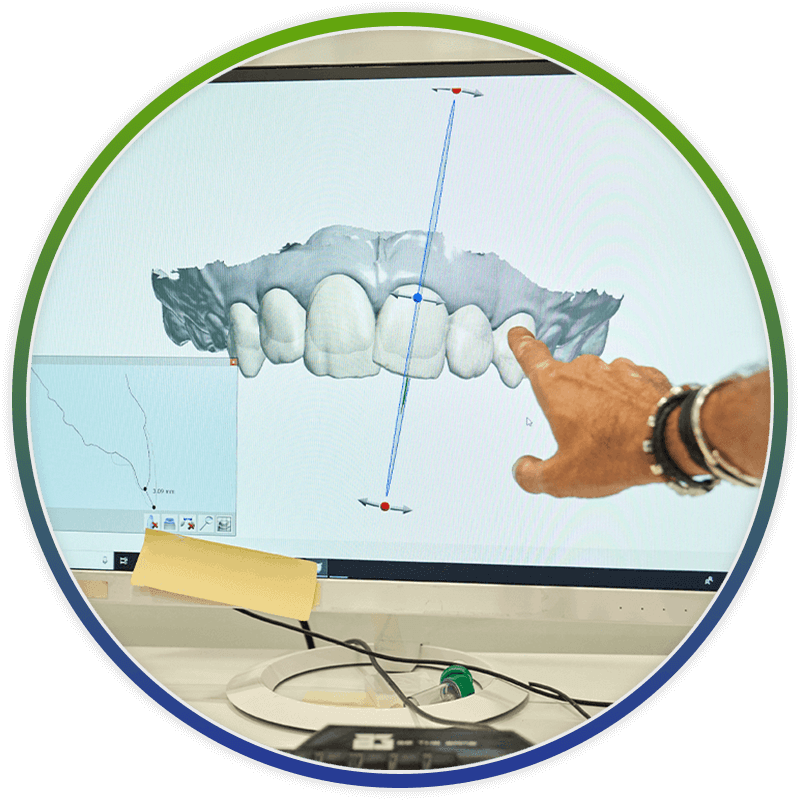 dentist pointing at 3d model of teeth on computer software