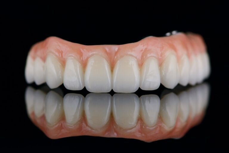 Close up animated image of a patient smiling, with a split screen showing before and after having full mouth implants put in. No text on the image.