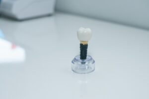 Dentist explaining dental implants to a patient with a 3D model