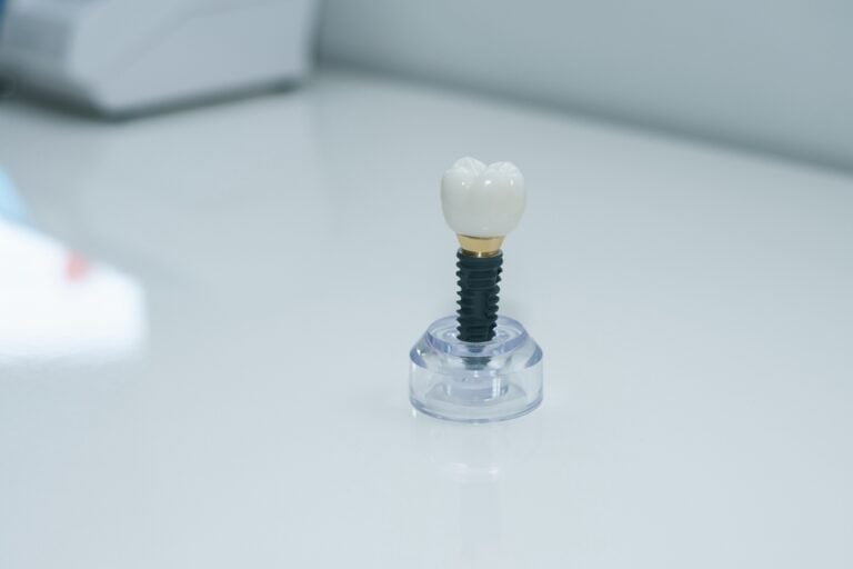 Dentist explaining dental implants to a patient with a 3D model