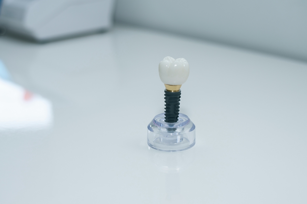 Dentist explaining dental implants to a patient with a 3D model
